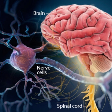 sclerosis
