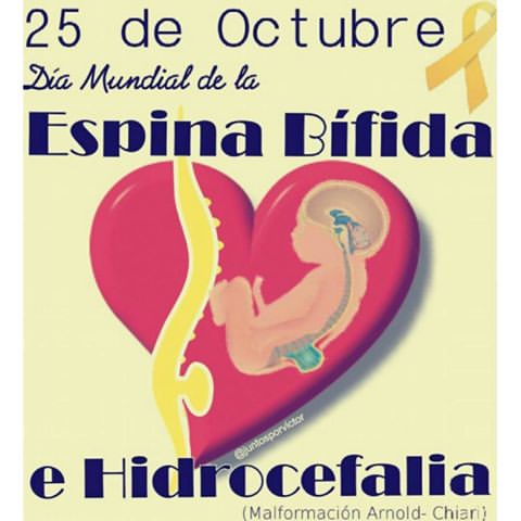 espina